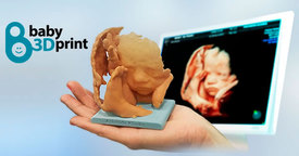 Baby3Dprint. Impresiones 3D del feto a partir de ecografías