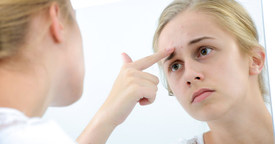 Cómo combatir el acné adolescente: trucos y remedios